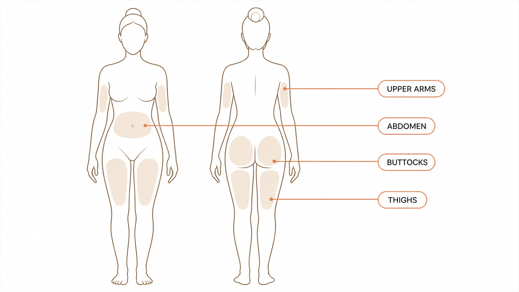 Front and back body map highlighting the upper arms, abdomen, buttocks and thighs