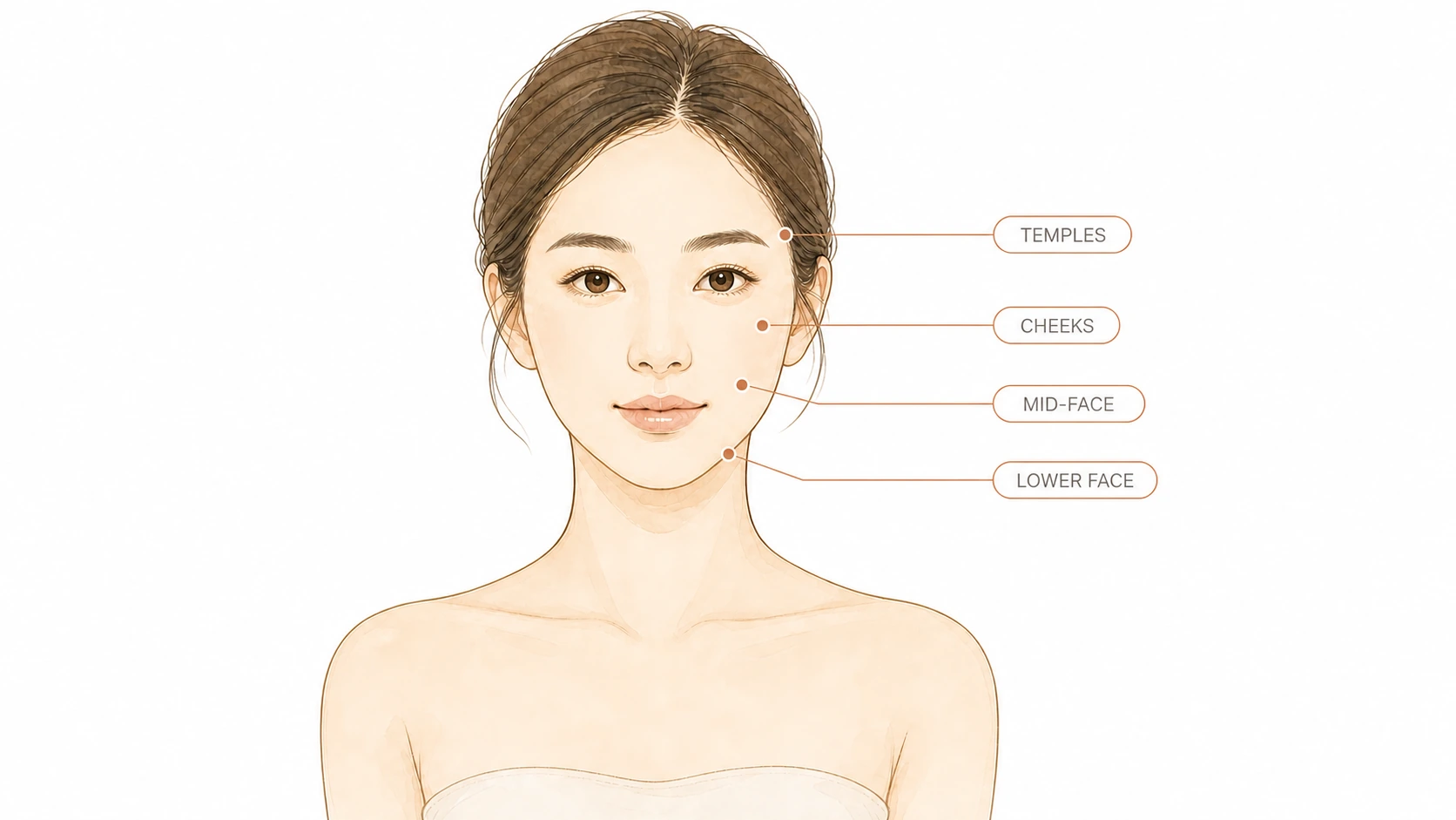 Illustration of a face with the temples, cheeks, mid-face and lower face marked