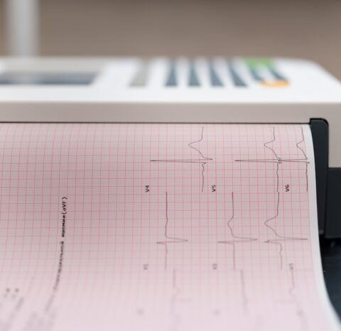a cardiologist makes an ECG cardiogram for a patient prints an analysis of patient's pulse rate and heartbeat in the clinic