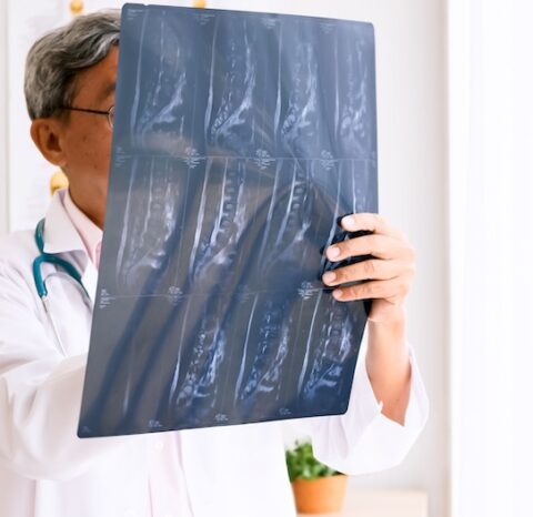Doctor reviewing an X-ray film