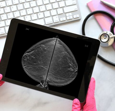 Mammogram images displayed on a tablet beside a stethoscope