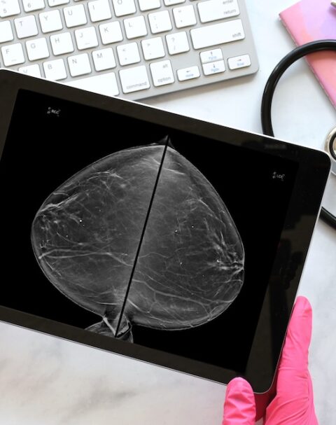 Mammogram images displayed on a tablet beside a stethoscope