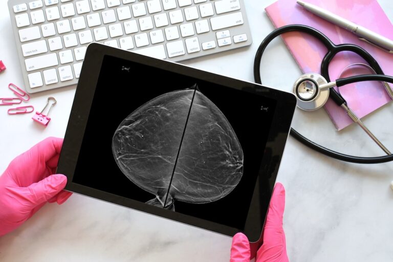 Dense Breasts Explained: Why Some Women May Need More Than a Mammogram