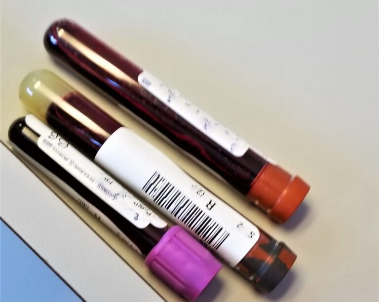 Understanding Your Health Screening Results: Common Blood Markers Explained