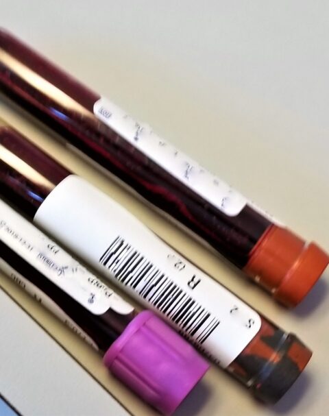 Blood sample tubes prepared for laboratory analysis